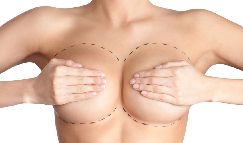 mamoplastia-aumento